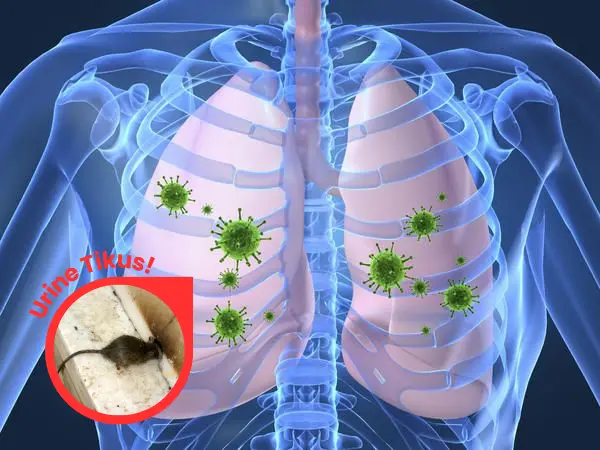 penyakit hantavirus yang disebabkan oleh urine tikus